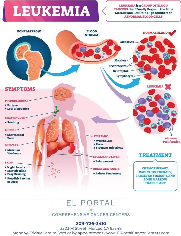 Leukemia overview