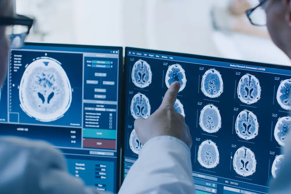 Doctor analyzing brain MRI scans on computer screens